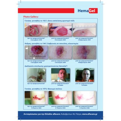 HemaGel 30gr - Image 3